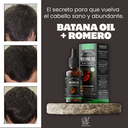 🫘 Transforma tu cabello y eleva tu confianza despues de ser mamá con el aceite de BATANA™ 🌿  en 30 días